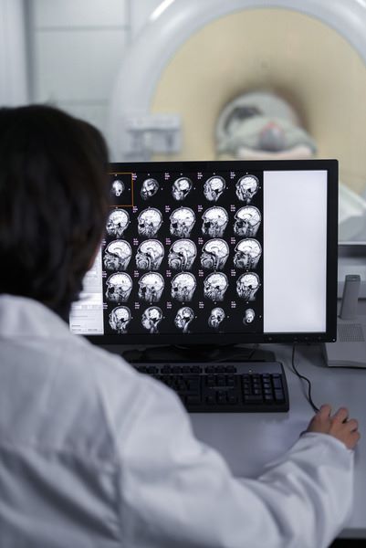 doctor looking into the CT scan to diagnose neurological problems